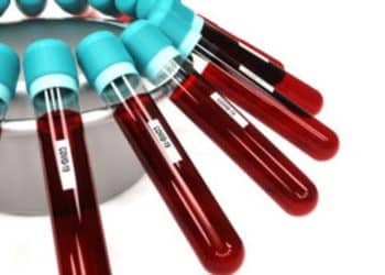 اختبار دم يكشف الميول الانتحارية للشخص.. لأول مرة