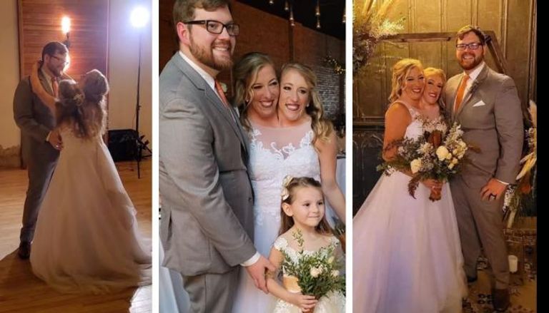 زواج أشهر توأم ملتصق في العالم