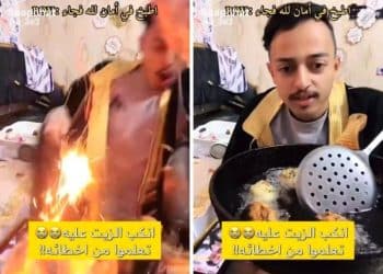 بث مباشر.. شاب يتعرض لحروق خطيرة من الزيت المغلي