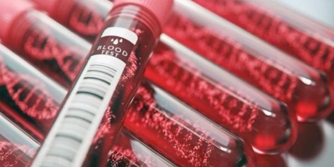 علاج جيني لفقر الدم المنجلي