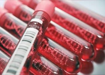 عاجل .. السعودية تتوصل إلي علاج جيني لفقر الدم المنجلي